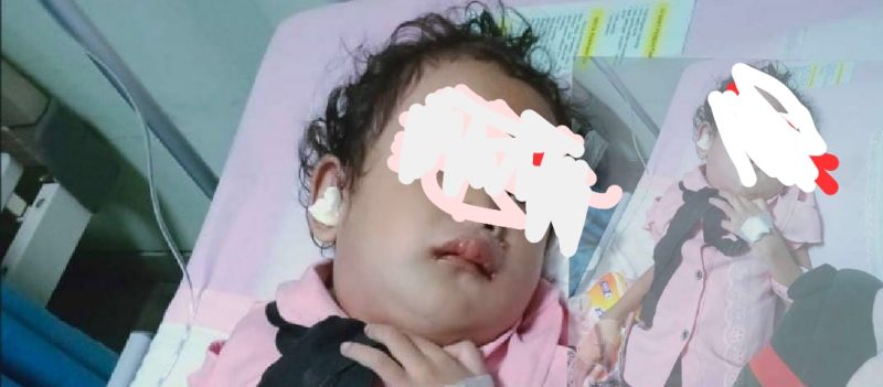 Umi Latifah Bocah 4 Tahun Harapkan Uluran Tangan dan Perhatian Pemkab Tubaba